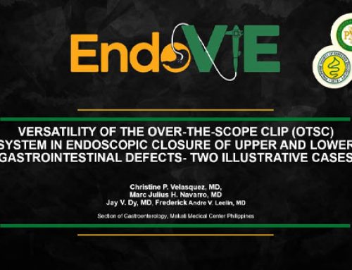 VERSATILITY OF THE OVER-THE-SCOPE CLIP (OTSC) SYSTEM FOR ENDOSCOPIC FULL-THICKNESS CLOSURE OF UPPER AND LOWER GASTROINTESTINAL DEFECTS: TWO ILLUSTRATIVE CASES