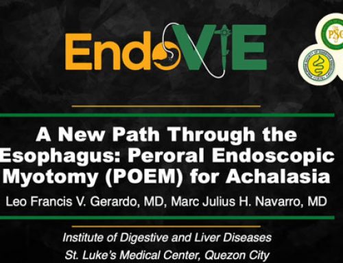 A NEW PATH THROUGH THE ESOPHAGUS: PERORAL ENDOSCOPIC MYOTOMY(POEM) FOR ACHALASIA