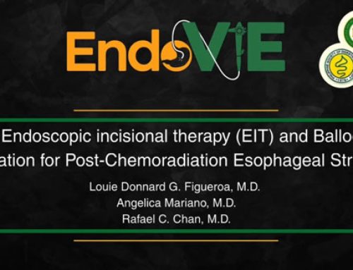 ENDOSCOPIC INCISIONAL THERAPY (EIT) AND BALLOON DILATION FOR POST-CHEMORADIATION ESOPHAGEAL STRICTURE