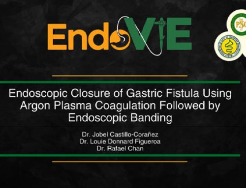 ENDOSCOPIC CLOSURE OF GASTRIC FISTULA USING ARGON PLASMA COAGULATION FOLLOWED BY ENDOSCOPIC BANDING