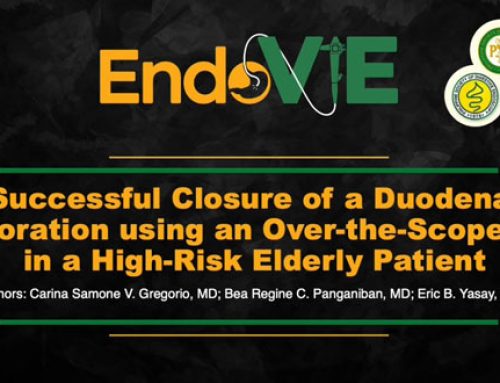 SUCCESSFUL CLOSURE OF A DUODENAL PERFORATION USING AN OVER-THE-SCOPE CLIP IN A HIGH-RISK ELDERLY PATIENT